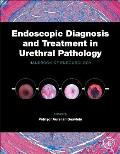 Endoscopic Diagnosis and Treatment in Urethral Pathology: Handbook of Endourology