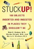 Stuck Up 100 Objects Inserted & Ingested in Places They Shouldnt Be