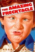 Amazing Frecktacle