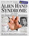 Alien Hand Syndrome & Other Too Weird