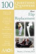 100 Questions & Answers about Hip Replacement