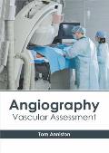 Angiography: Vascular Assessment