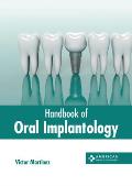 Handbook of Oral Implantology