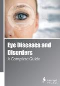 Eye Diseases and Disorders: A Complete Guide