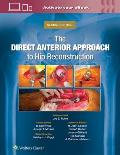 The Direct Anterior Approach to Hip Reconstruction