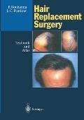 Hair Replacement Surgery: Textbook and Atlas