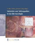Fallstricke Und Fehlerquellen in Der Dermatologie