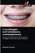 L'incollaggio nell'ortodonzia contemporanea